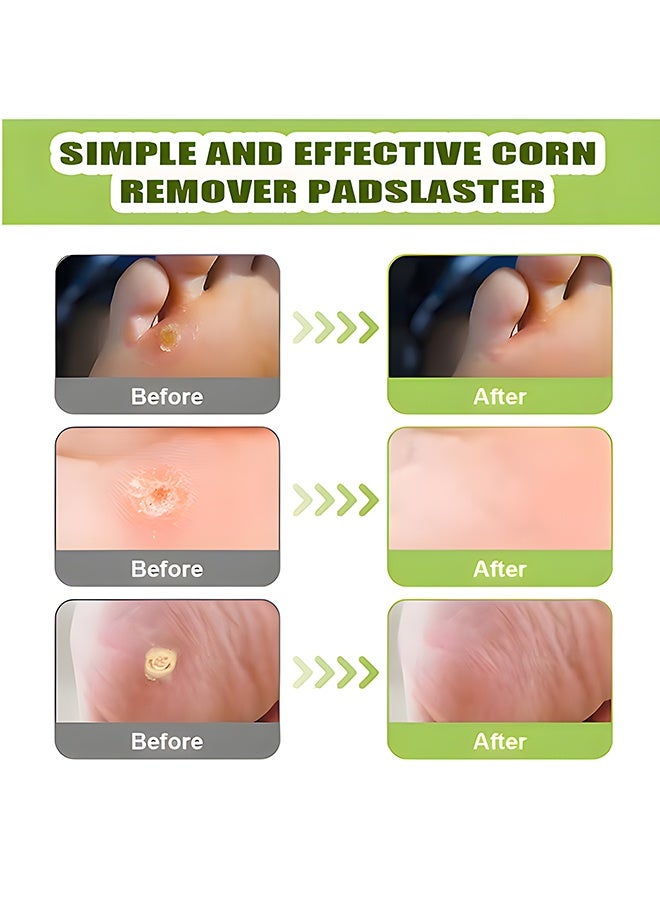 Corn Remover Pads (36 Pcs) – Effective Foot Corn & Callus Plasters, Natural Wart Removal Caps with Strong Adhesion - Image 3